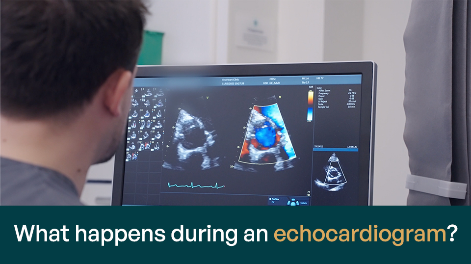 What happens during an echocardiogram? – video with Dr Ravi Assomull